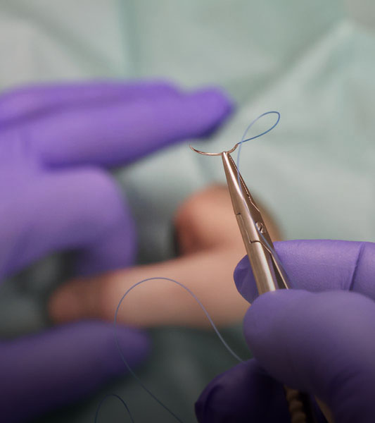 Wundversorgung in der Hausarztpraxis Dr. Strosing im Hexental